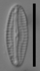 Microcostatus
