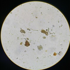 Cosmarium contractum