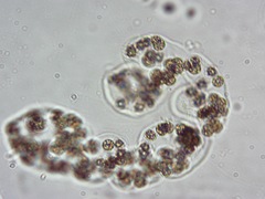 Microcystis wesenbergii