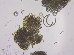 Dolichospermum lemmermannii