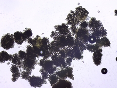 Dolichospermum lemmermannii