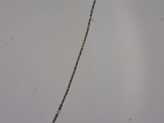 Dolichospermum planctonicum