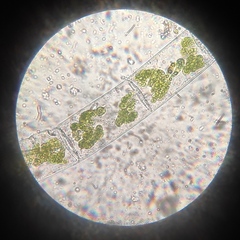Spirogyra