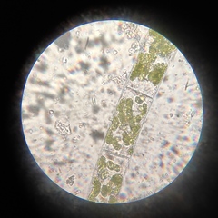 Spirogyra