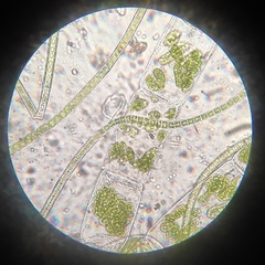 Spirogyra