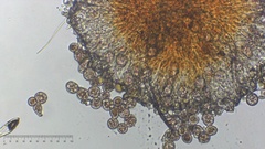 Melampsora ribesii-viminalis