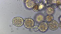 Melampsora ribesii-viminalis