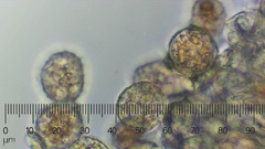 Melampsora ribesii-viminalis