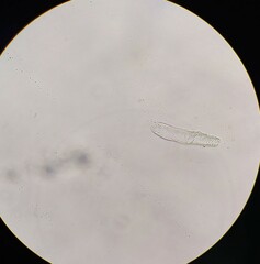 Sellaphora pupula