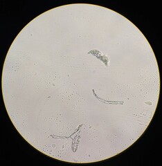Planktothrix rubescens