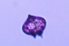 Protoperidinium