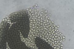 Pilobolus crystallinus