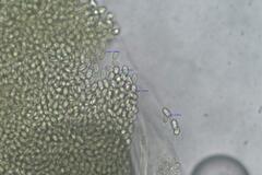 Pilobolus crystallinus