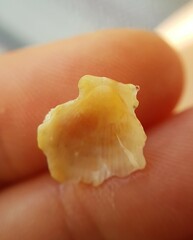 Talochlamys pusio