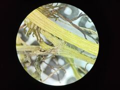 Ranunculus subrigidus