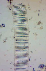 Fragilaria