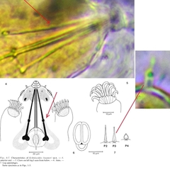 Echiniscoides hoepneri