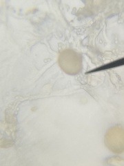 Chytridiomycota