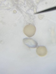 Chytridiomycota