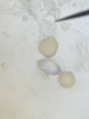 Chytridiomycota