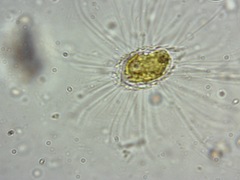 Mallomonas caudata