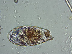 Euglypha