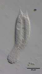 Aspidiophorus oculifer