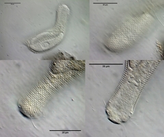 Aspidiophorus oculifer