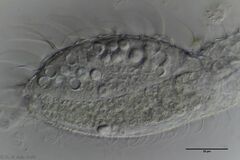 Chaetonotus cordiformis