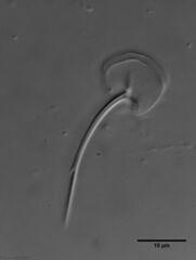 Chaetonotus cordiformis