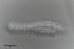 Chaetonotus acanthocephalus