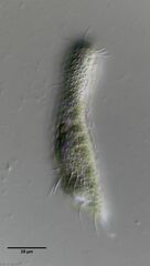 Chaetonotus acanthodes