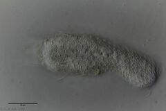 Chaetonotus acanthodes