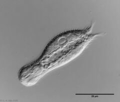 Chaetonotus multispinosus