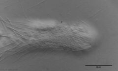 Chaetonotus hoanicus