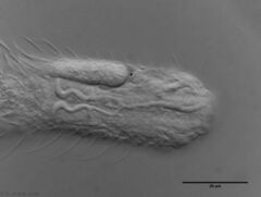 Chaetonotus hoanicus