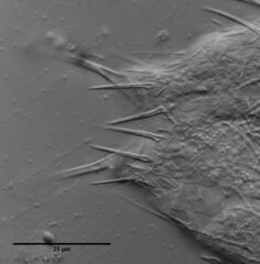 Chaetonotus hoanicus