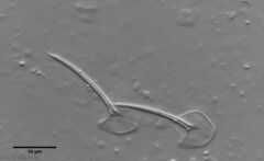 Chaetonotus hoanicus