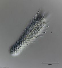 Chaetonotus murrayi