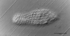 Chaetonotus italicus