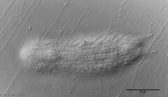 Chaetonotus italicus