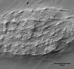 Chaetonotus italicus