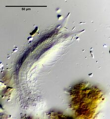 Chaetonotus novenarius