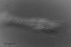 Chaetonotus novenarius