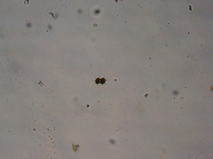 Xanthidium antilopaeum