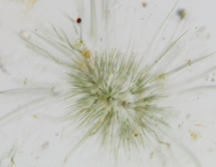 Gloeotrichia