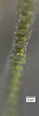 Teilingia granulata
