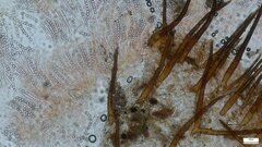 Scutellinia
