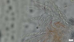 Scutellinia