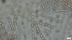 Scutellinia